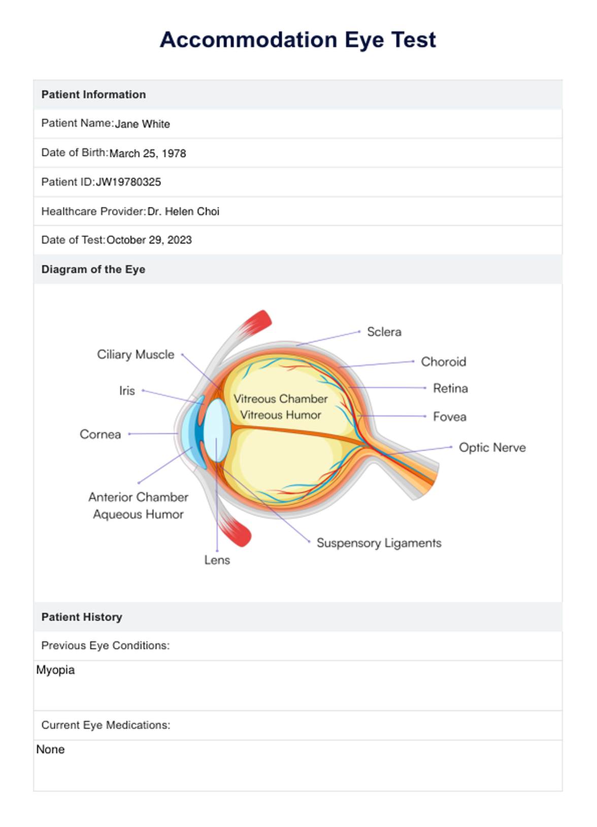 Accommodation Eye Test PDF Example