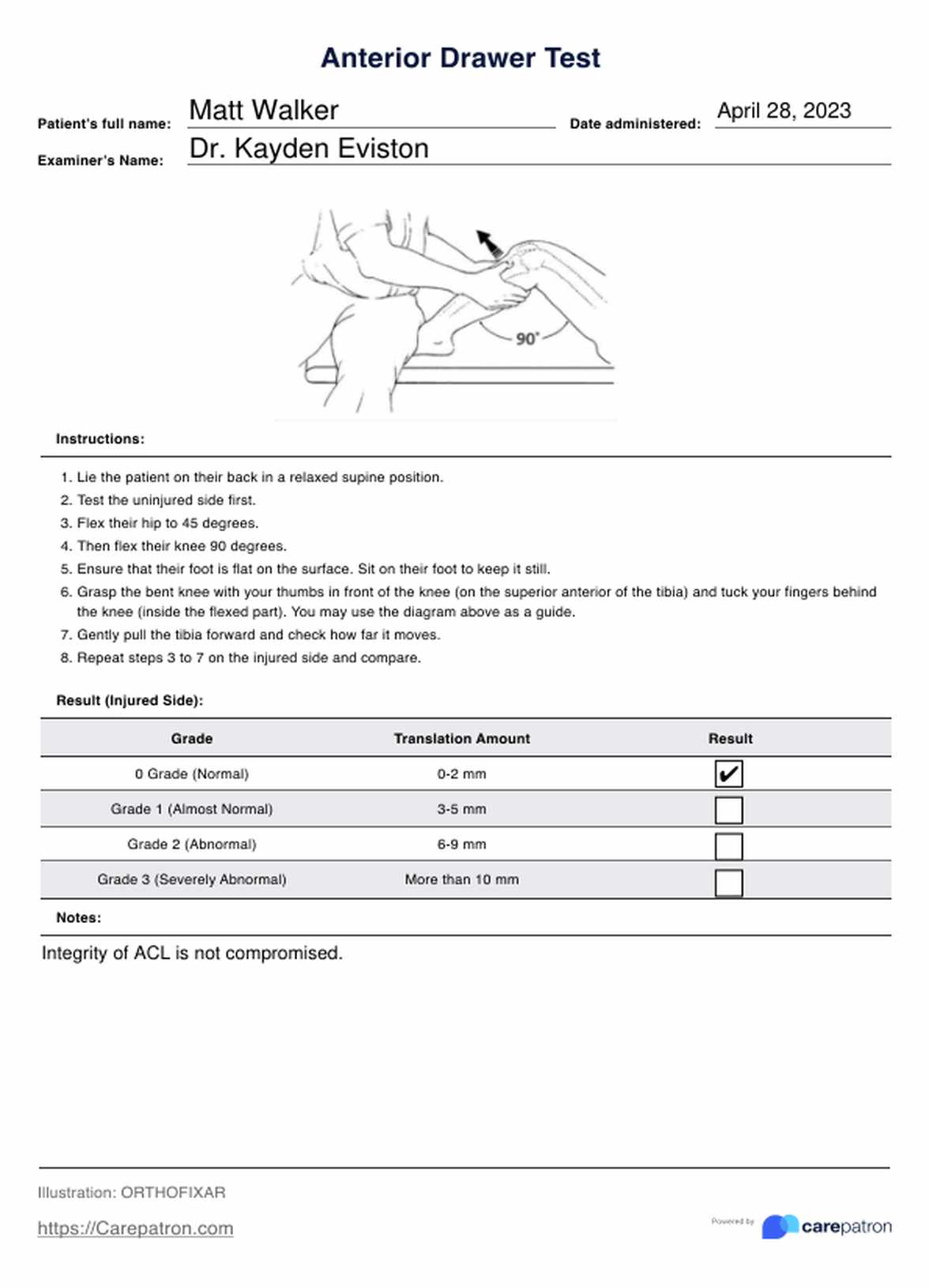 Anterior Drawer Tests PDF Example