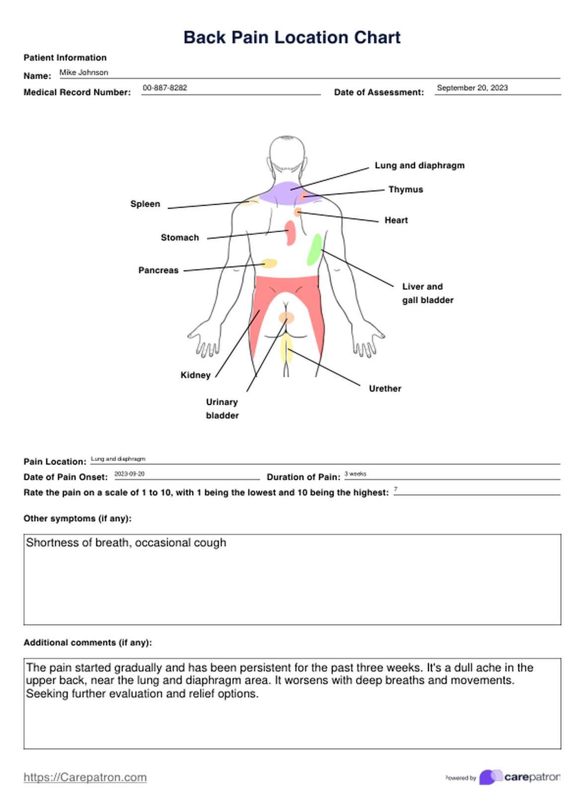 Back Pain Location Charts PDF Example
