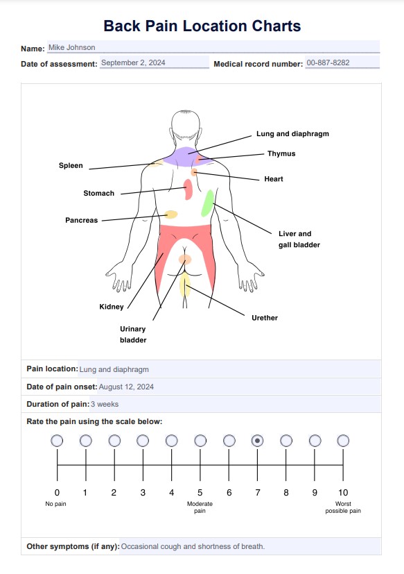 Wykresy lokalizacji bólu pleców PDF Example