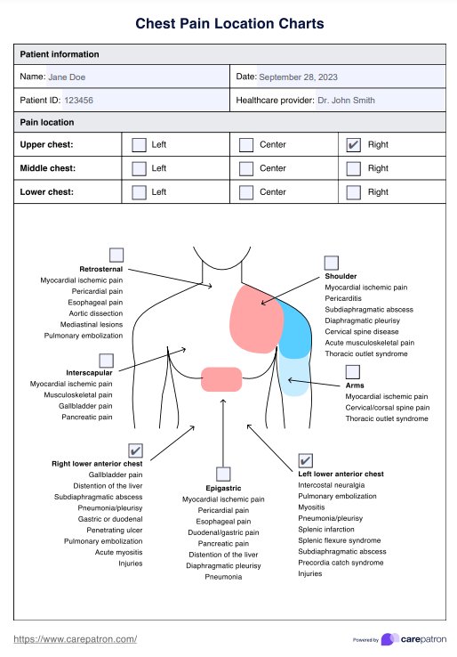 Gráficos de localização da dor torácica PDF Example