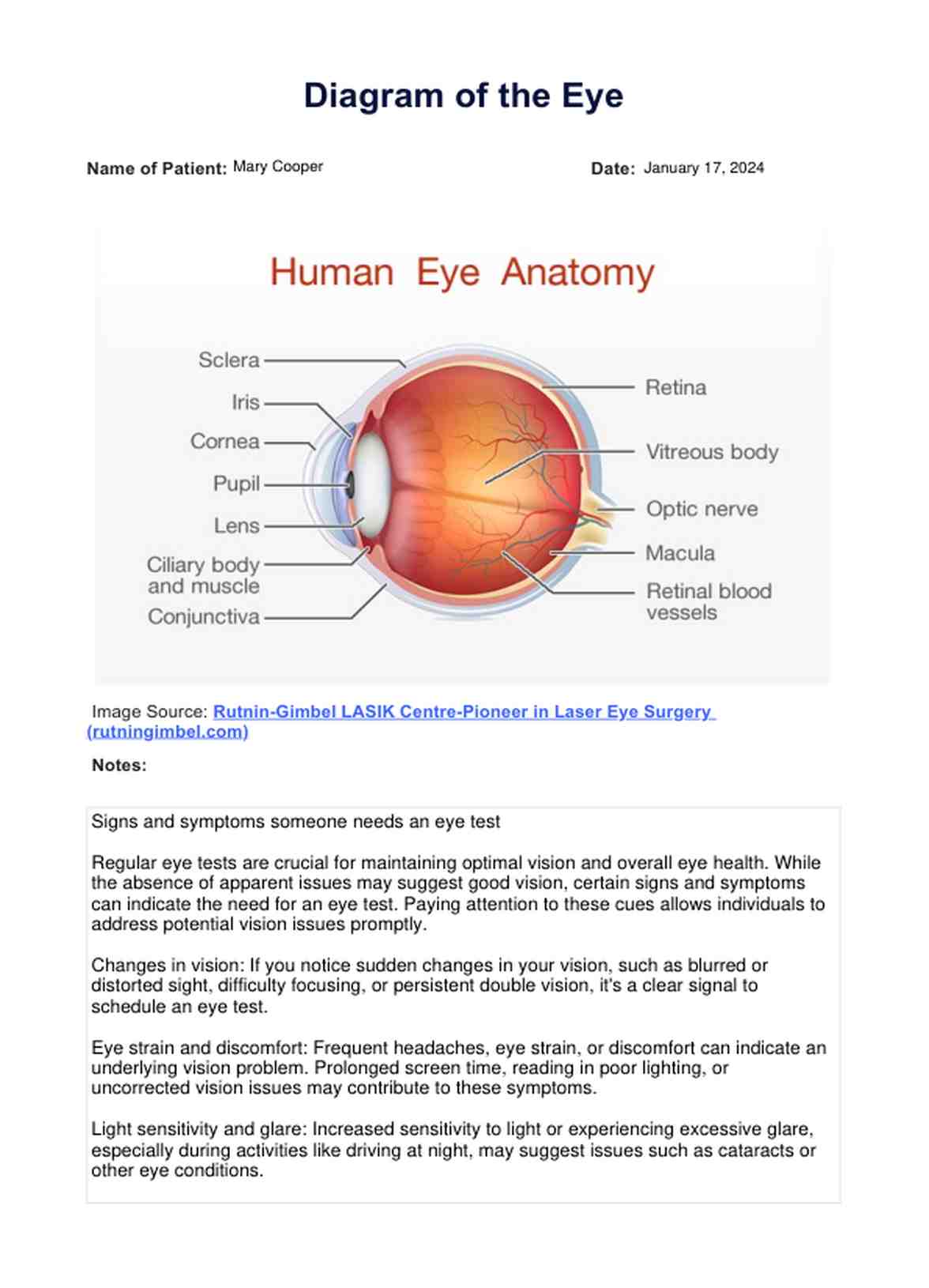 Diagram of the Eye PDF Example