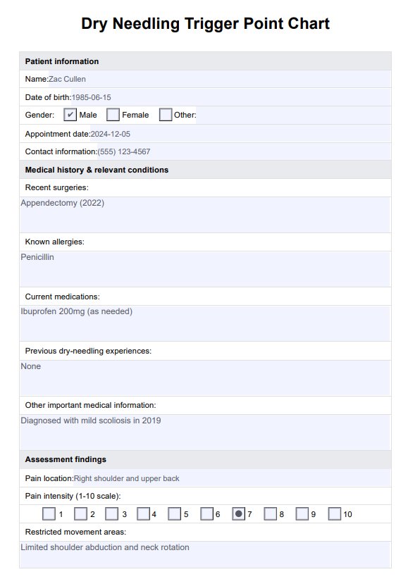 Dry Needling Trigger Point Charts PDF Example