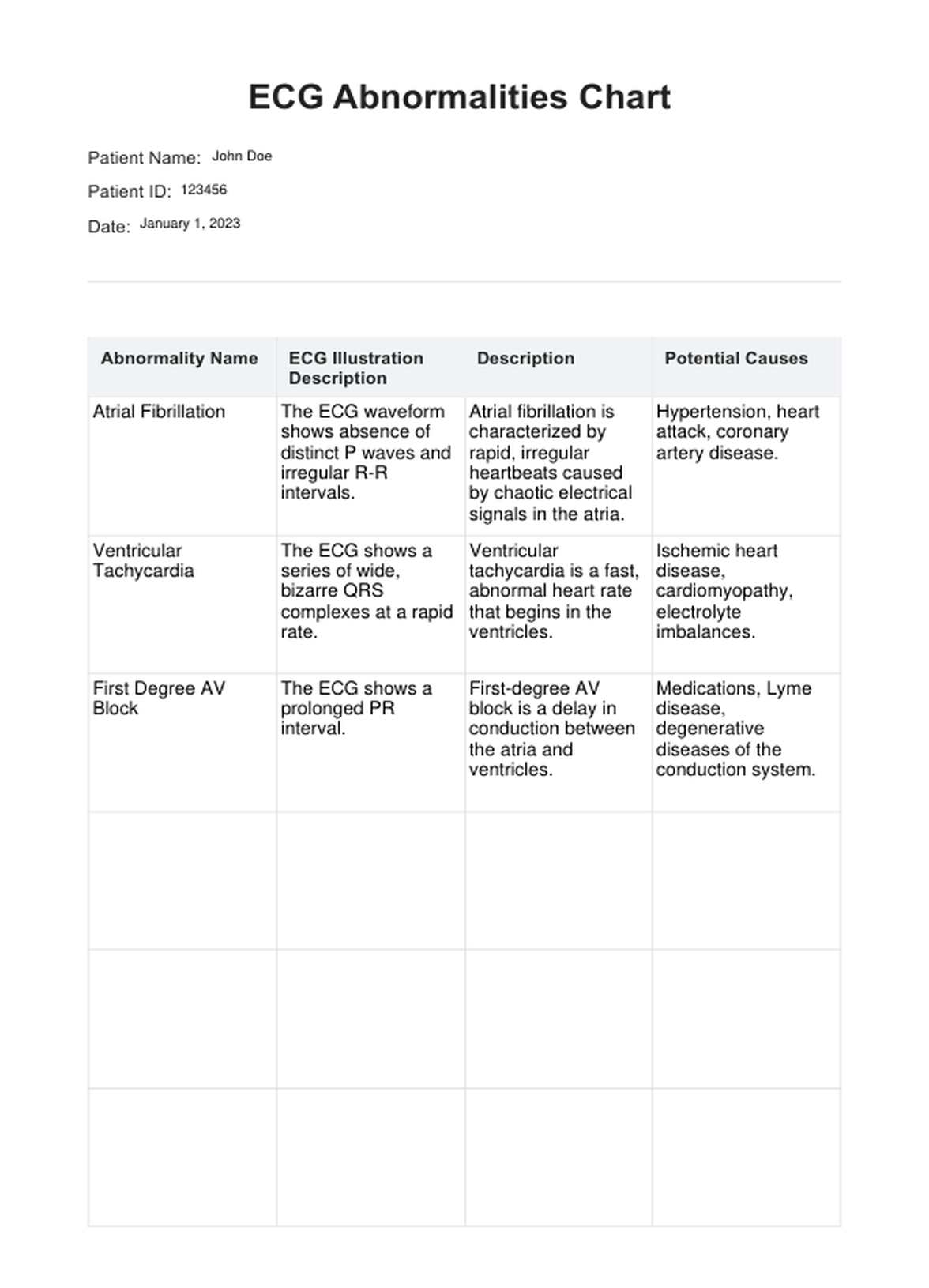 ECG Abnormalities Chart PDF Example