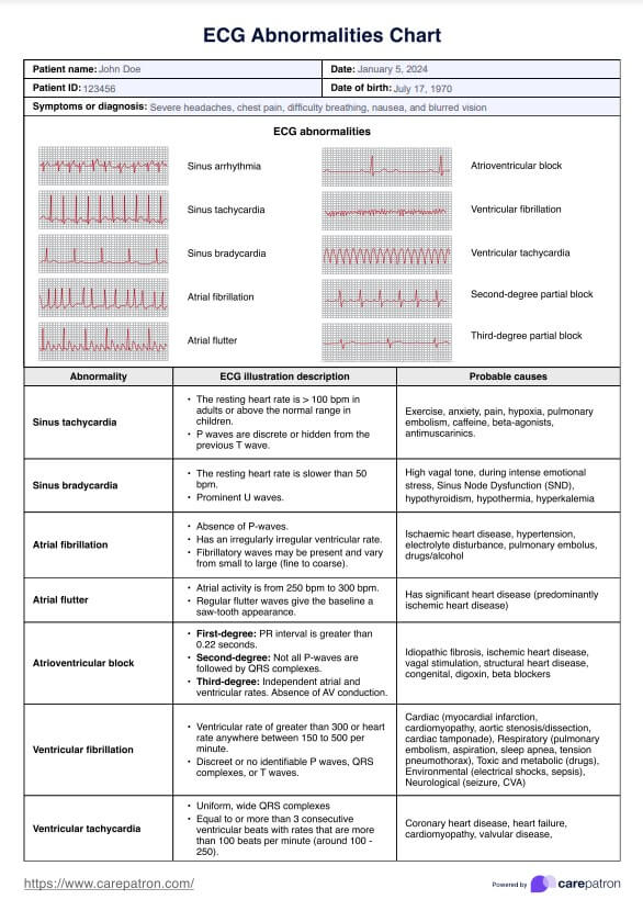 ECG Abnormalities Chart & Example | Free PDF Download