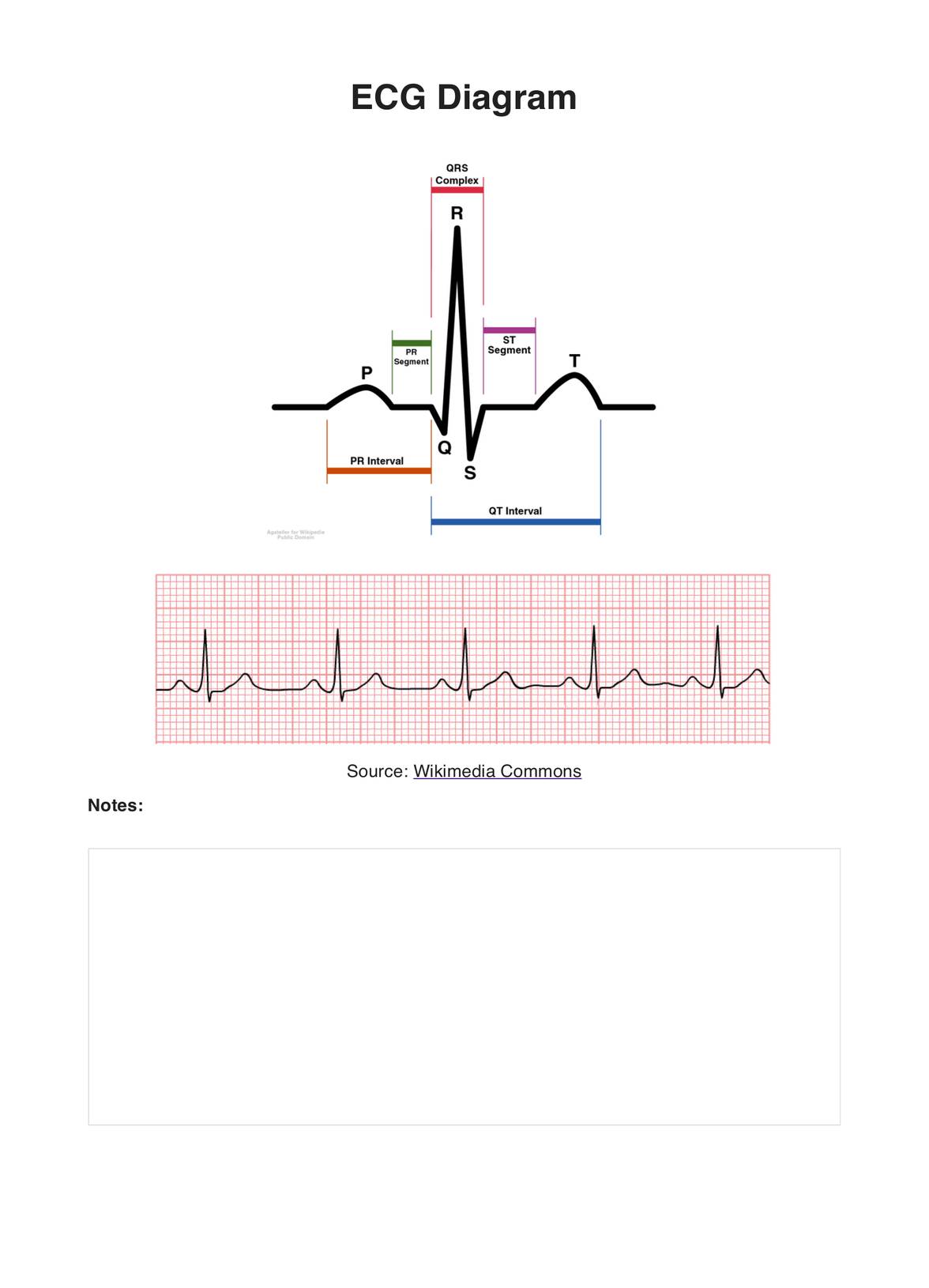 ECG Diagram PDF Example