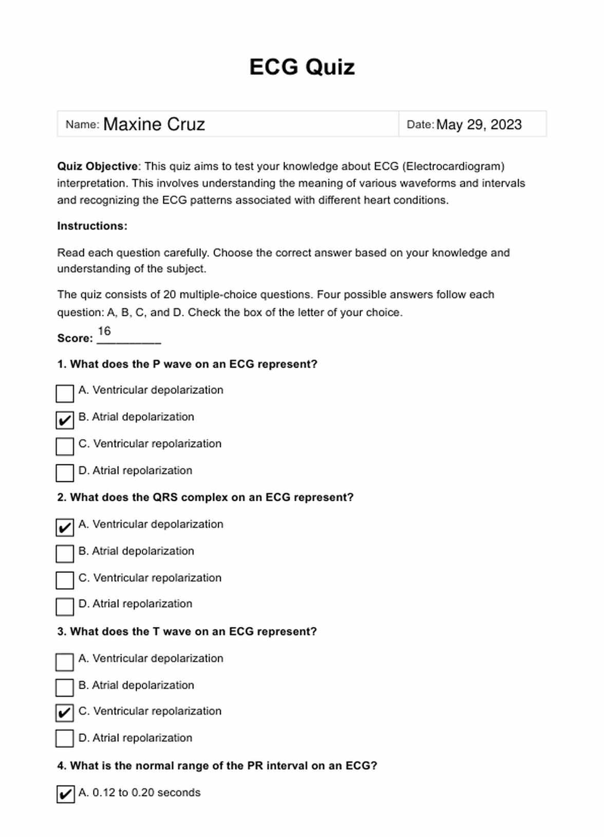ECG Quiz PDF Example