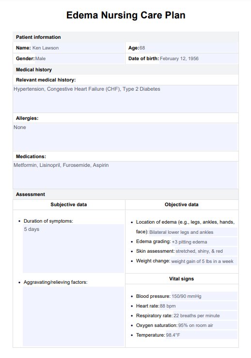 Plan de cuidado de edema PDF Example
