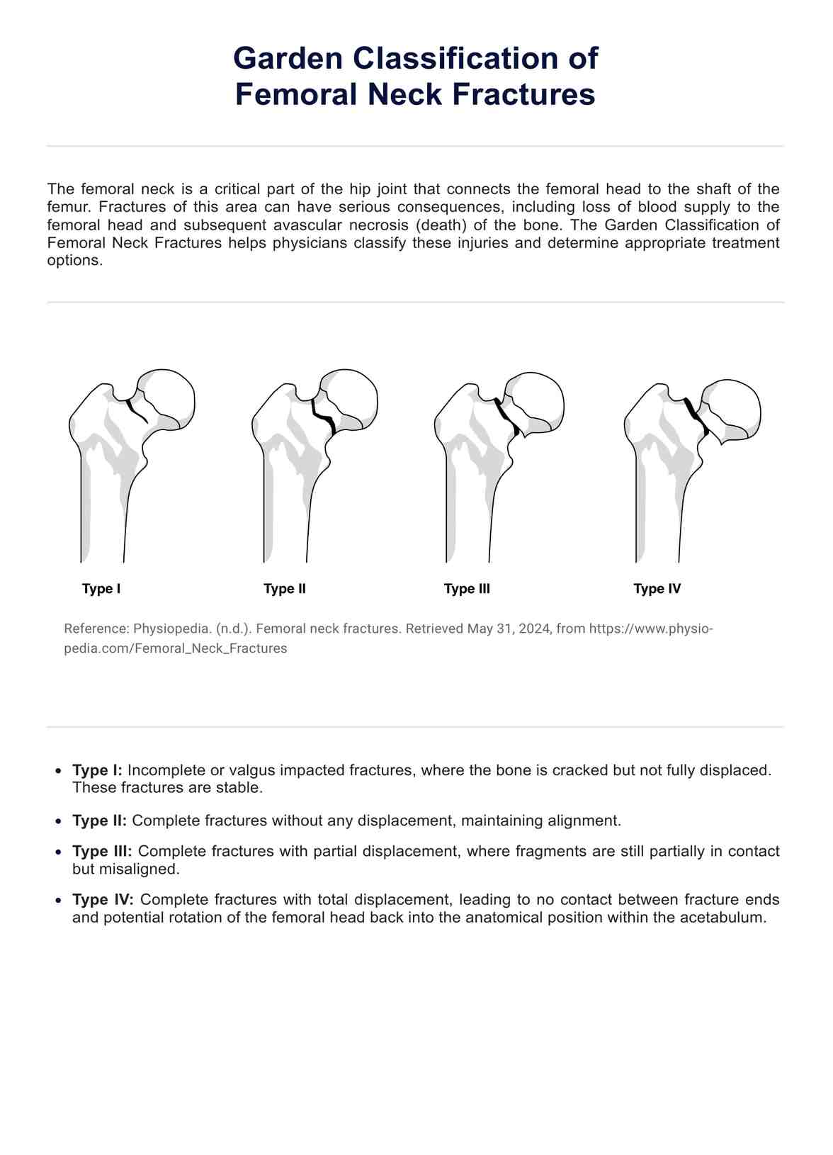 Garden Classification of Femoral Neck Fractures PDF PDF Example