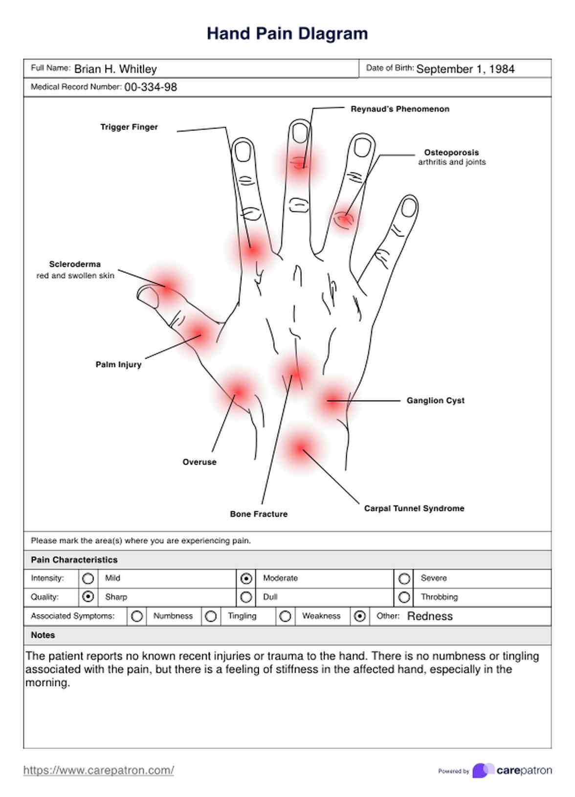 Hand Pain Diagrams PDF Example