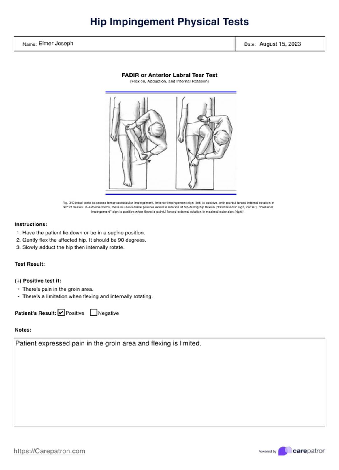 Hip Impingement Tests PDF Example