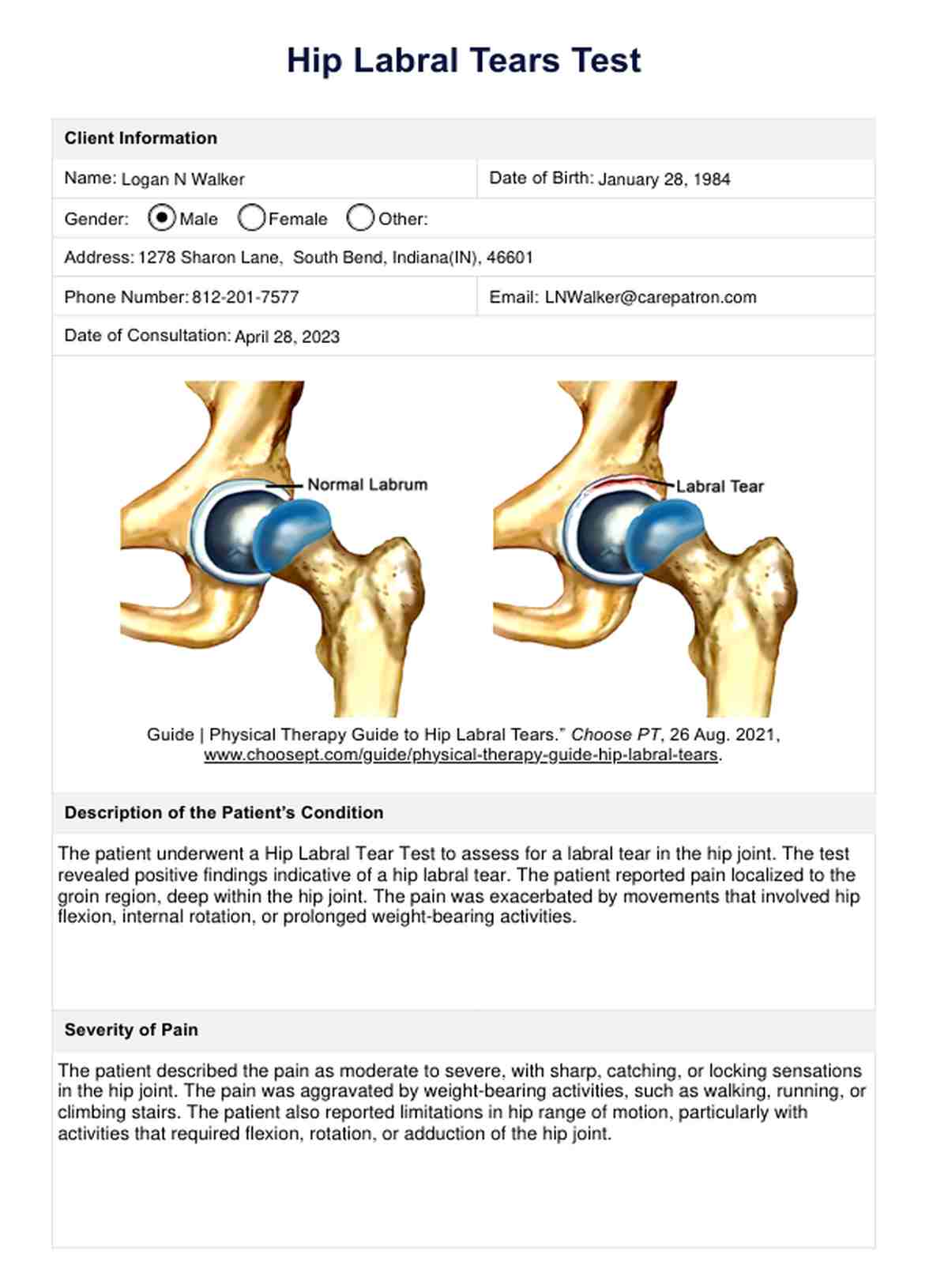Hip Labral Tears Test PDF Example
