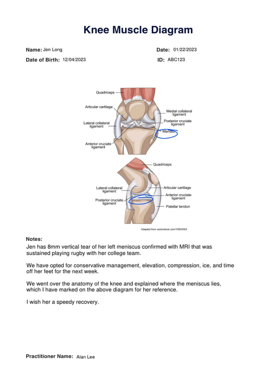Knee Muscle Diagram PDF Example