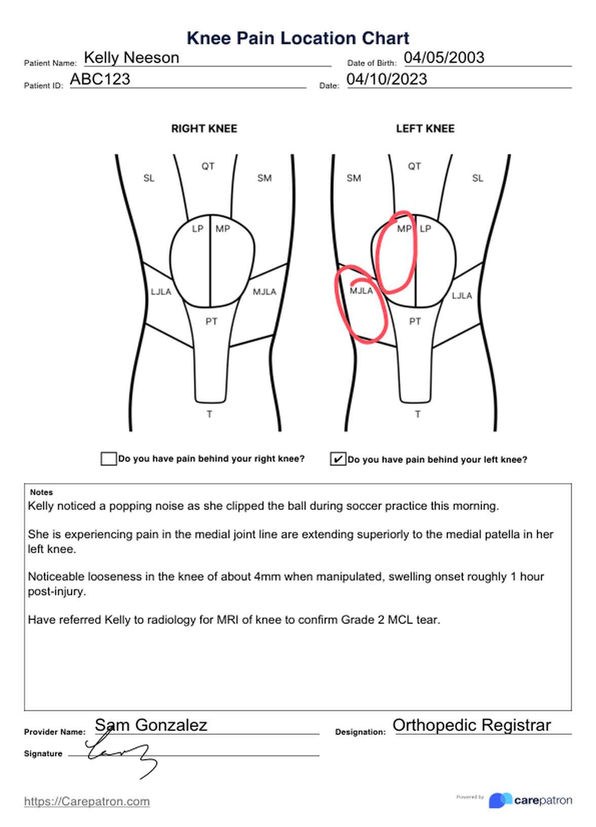 Knee Pain Location Chart PDF Example