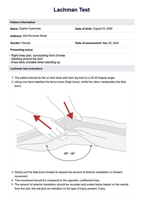 Prueba de lachman PDF Example