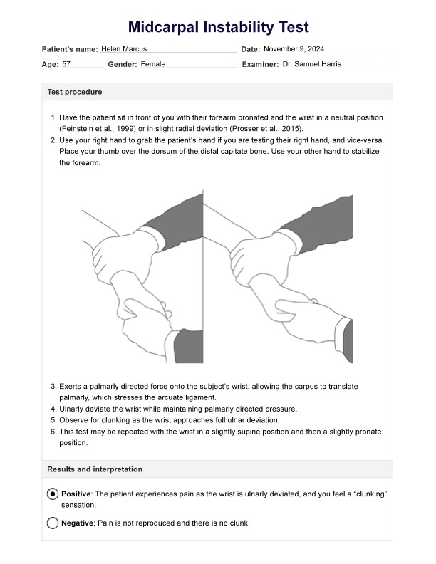 Midcarpal Instability Test PDF Example