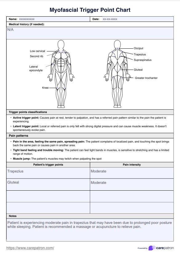 मायोफेशियल ट्रिगर पॉइंट चार्ट PDF Example