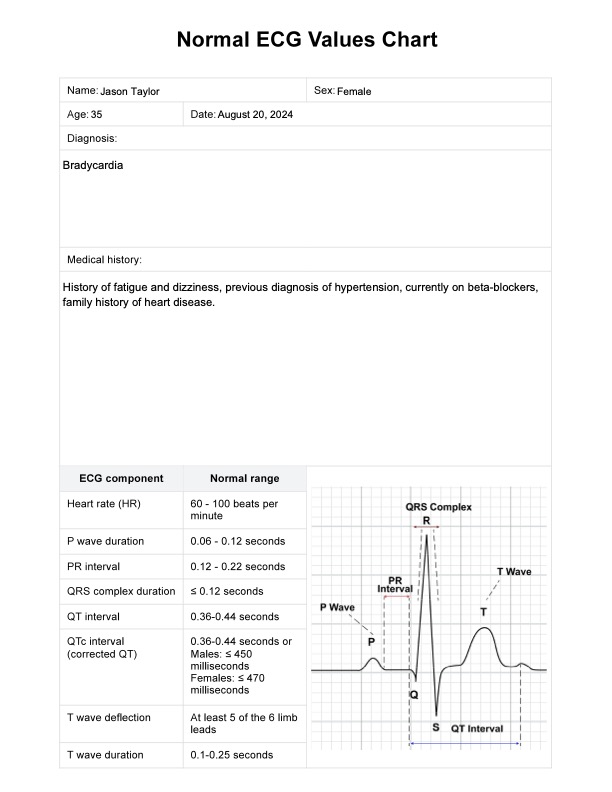 Normale EKG-værdidiagrammer PDF Example