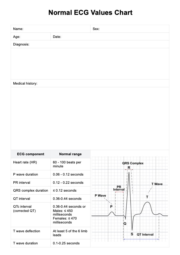 Grafici dei valori ECG normali PDF Example