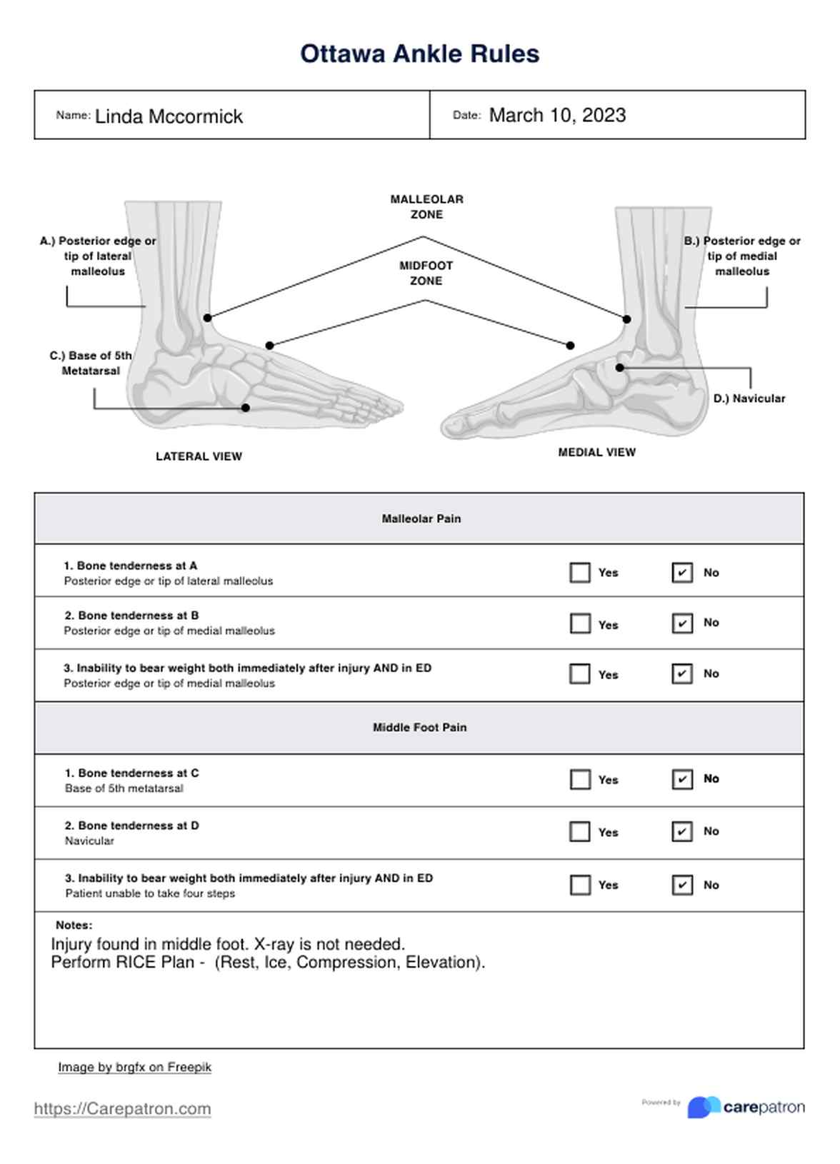Ottawa Ankle Rules PDF Example