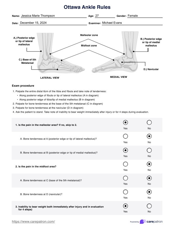 Ottawa Ankle Rules PDF Example