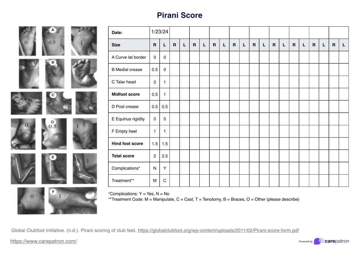 Pirani Score PDF Example
