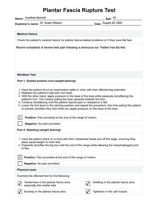 Test de rupture du fascia plantaire PDF Example