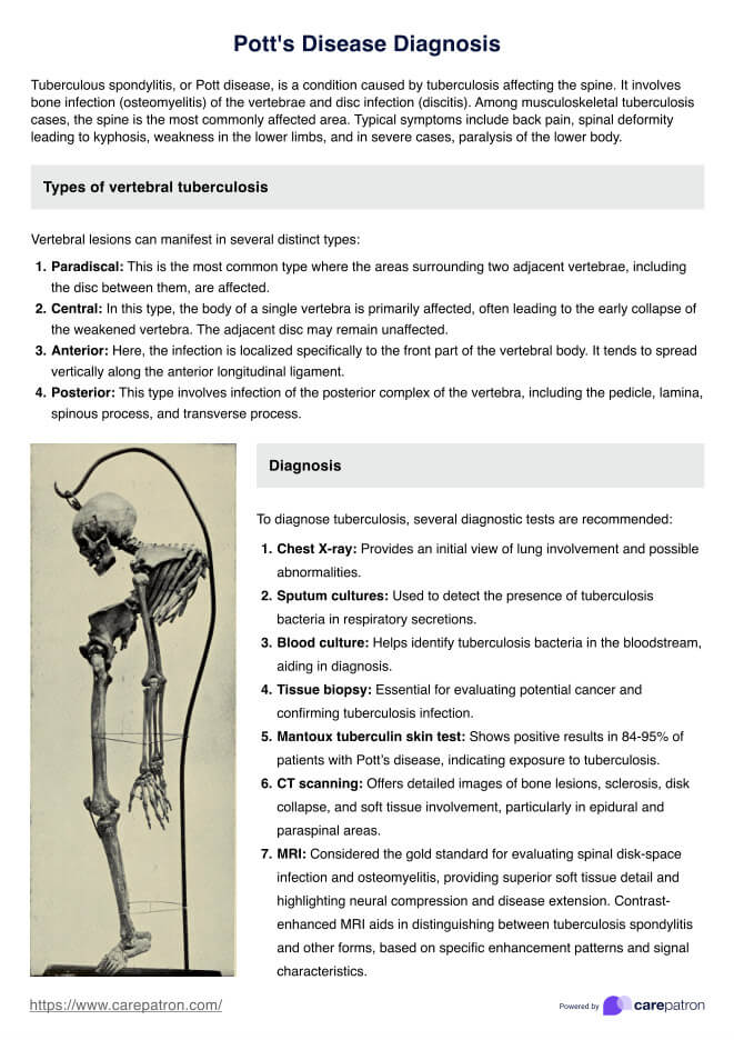 Pott's Disease Diagnosis Guidelines PDF Example
