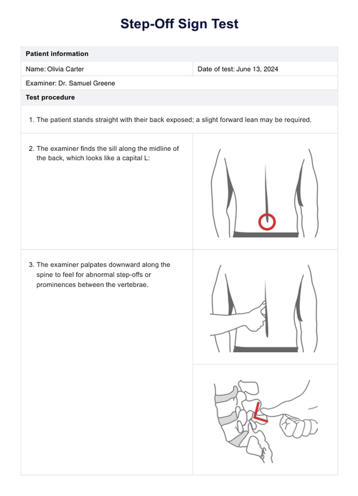 Prueba de señal de paso PDF Example