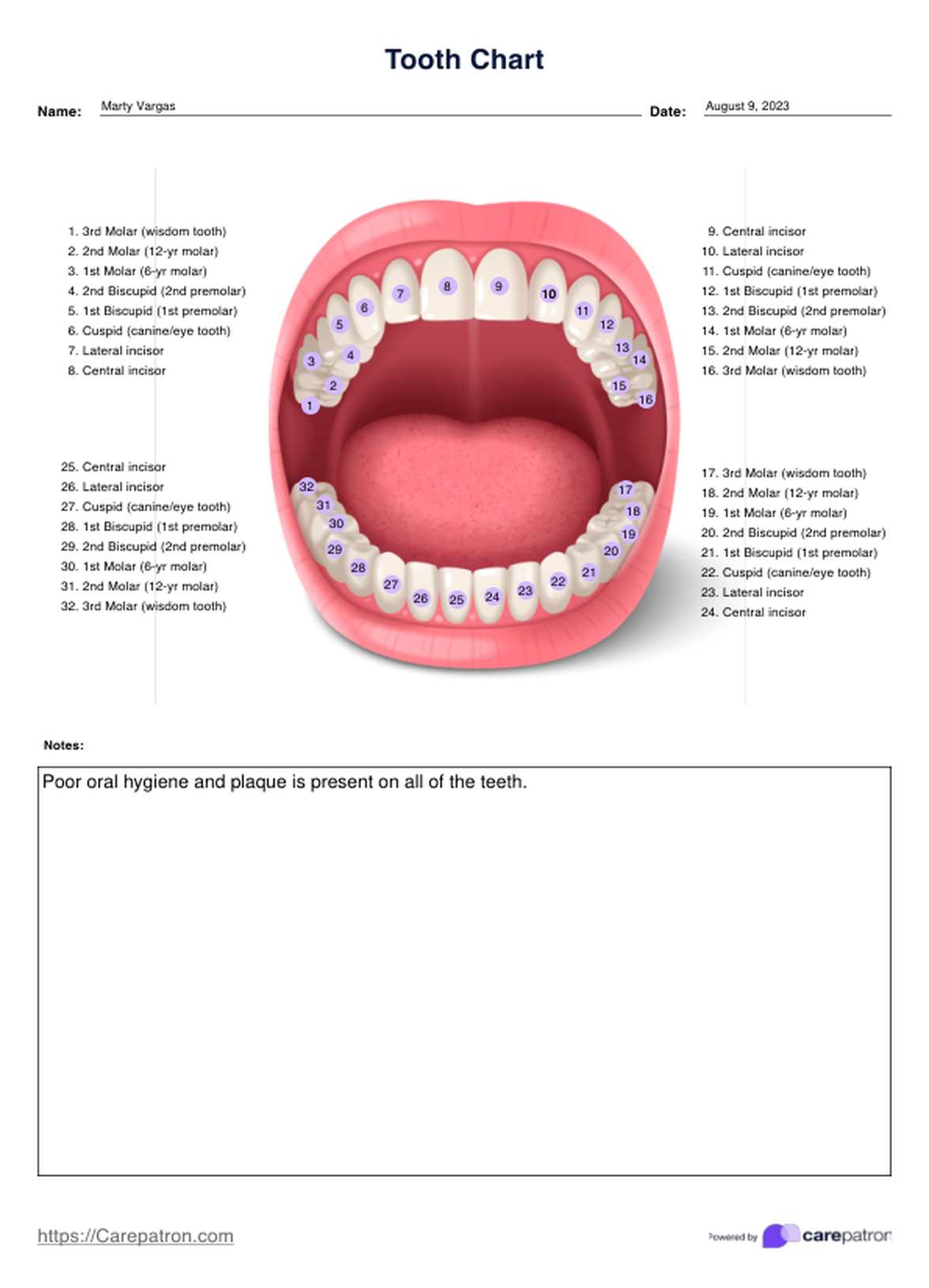 Tooth Charts PDF Example