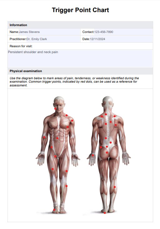 Trigger Point Charts PDF Example