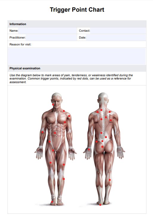 Trigger Point Charts PDF Example