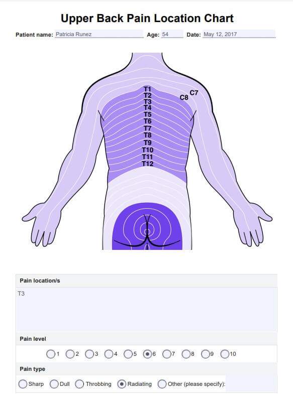 Lageplan für Schmerzen im oberen Rückenbereich PDF Example